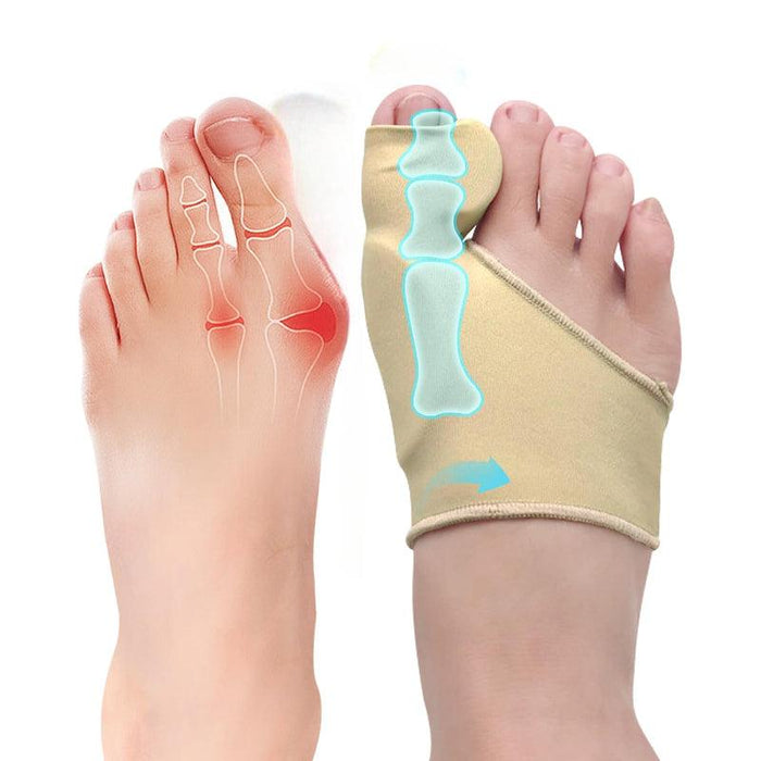 2-Piece Bunion Relief Socks - Toe Straightener and Comfort