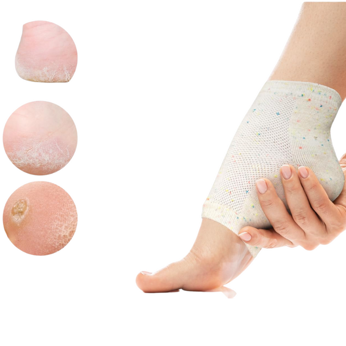 Moisturizing Gel Socks – Intensive Repair for Soft and Smooth Feet