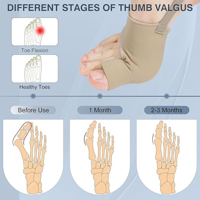 1 Pair Orthopedic Bunion Relief Socks - Hallux Valgus Correction