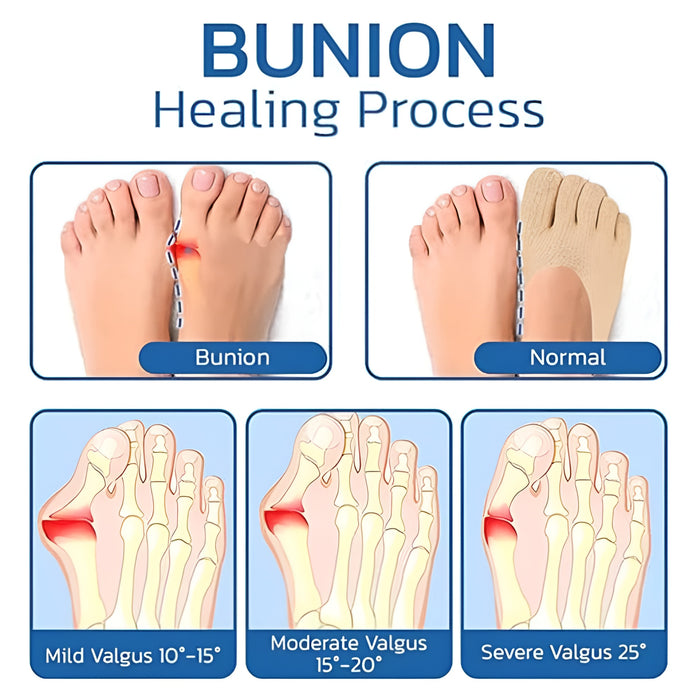 5 Pair Anti Bunion Socks - Non-Slip Silicone Support